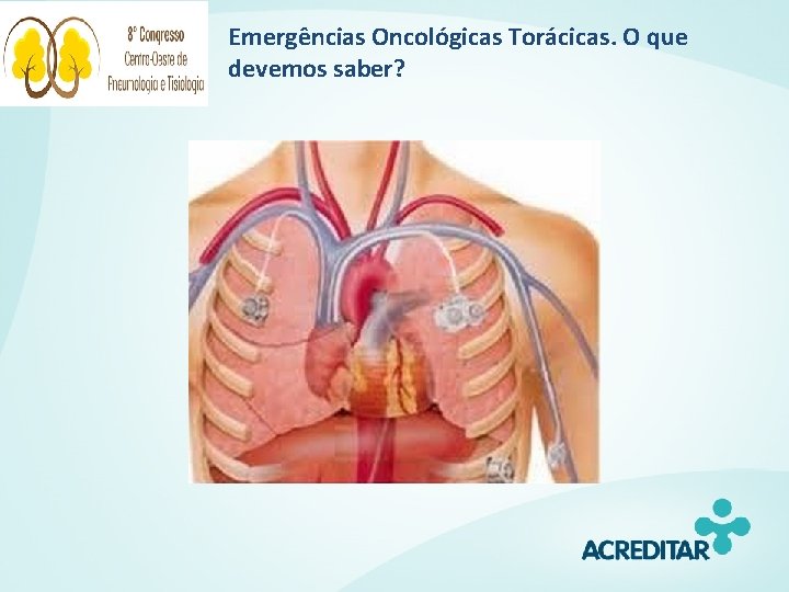 Emergências Oncológicas Torácicas. O que devemos saber? 