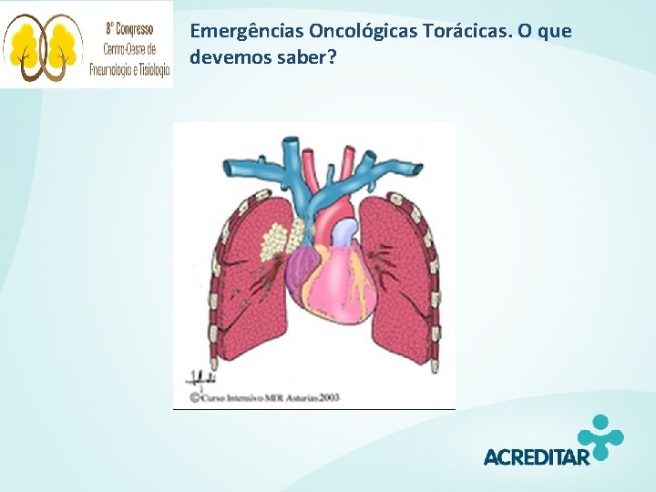 Emergências Oncológicas Torácicas. O que devemos saber? 