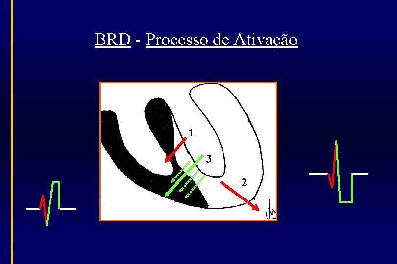 BRD - Processo de Ativação 1 3 2 