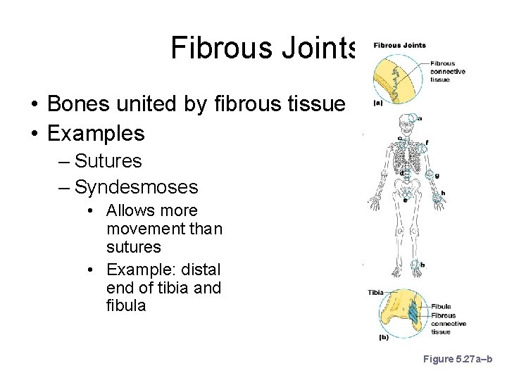 Fibrous Joints • Bones united by fibrous tissue • Examples – Sutures – Syndesmoses