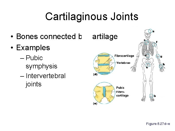 Cartilaginous Joints • Bones connected by cartilage • Examples – Pubic symphysis – Intervertebral