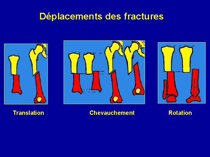 Déplacements des fractures Translation Chevauchement Rotation 