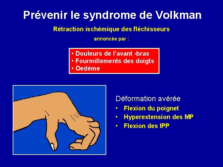 Prévenir le syndrome de Volkman Rétraction ischémique des fléchisseurs annoncée par : • Douleurs