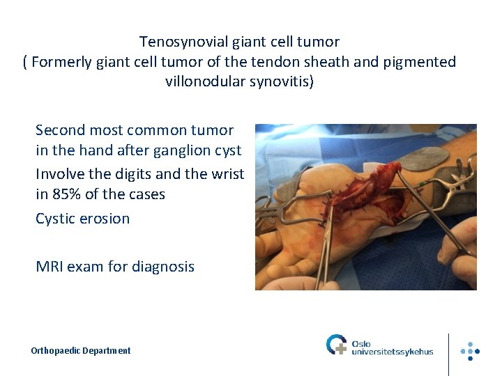 Tenosynovial giant cell tumor ( Formerly giant cell tumor of the tendon sheath and