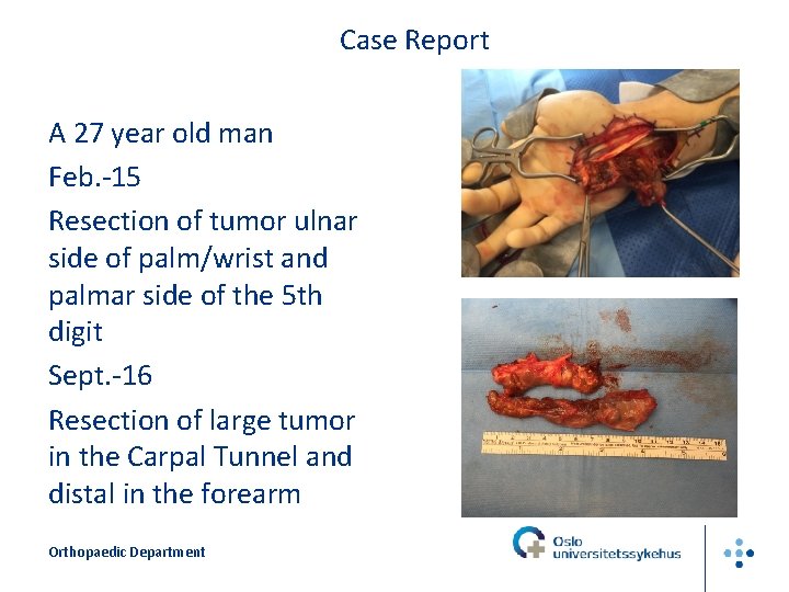 Case Report A 27 year old man Feb. -15 Resection of tumor ulnar side