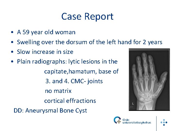 Case Report • • A 59 year old woman Swelling over the dorsum of
