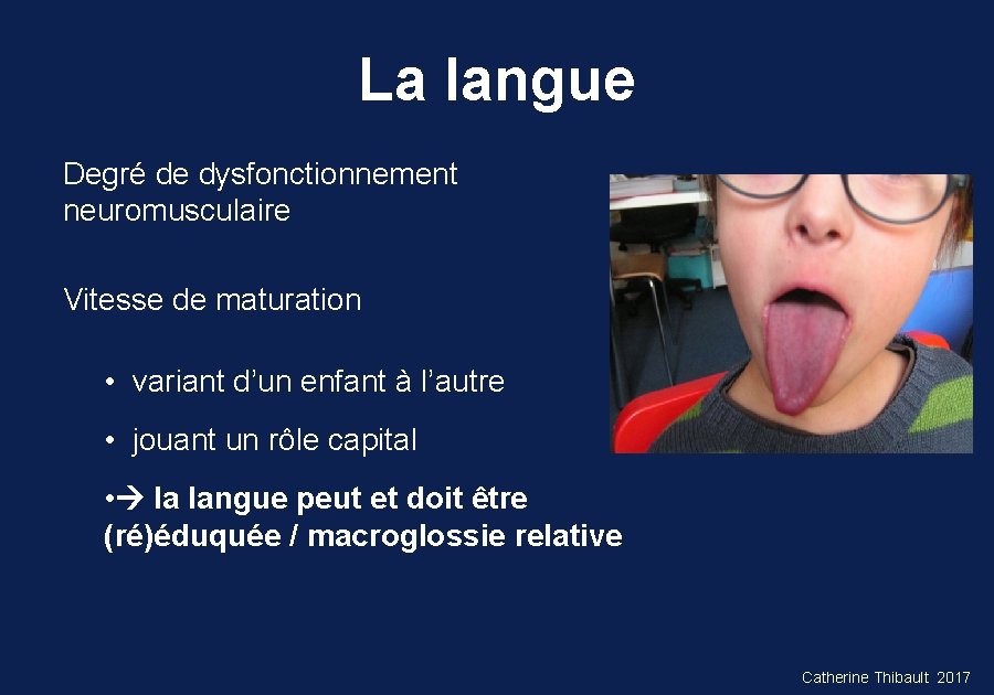 La langue Degré de dysfonctionnement neuromusculaire Vitesse de maturation • variant d’un enfant à