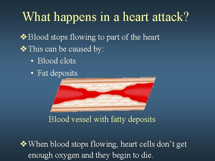 What happens in a heart attack? v Blood stops flowing to part of the