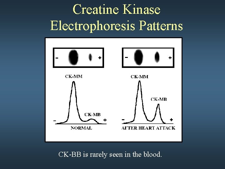 Creatine Kinase Electrophoresis Patterns CK-BB is rarely seen in the blood. 