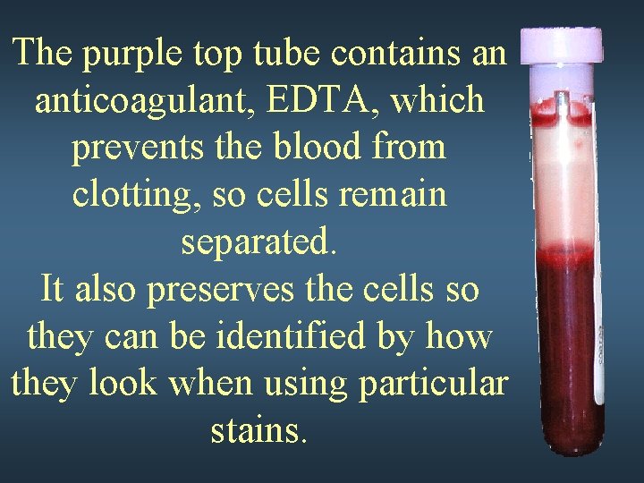 The purple top tube contains an anticoagulant, EDTA, which prevents the blood from clotting,