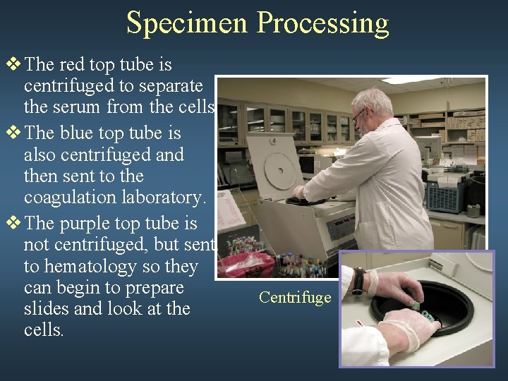 Specimen Processing v The red top tube is centrifuged to separate the serum from