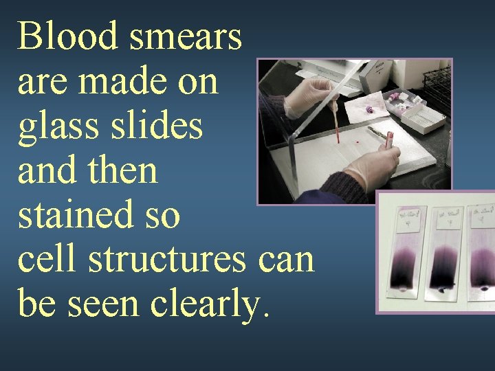 Blood smears are made on glass slides and then stained so cell structures can