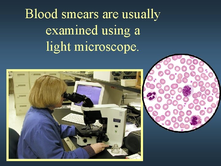 Blood smears are usually examined using a light microscope. 