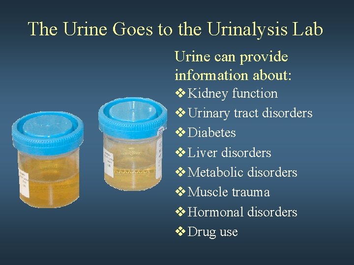 The Urine Goes to the Urinalysis Lab Urine can provide information about: v Kidney