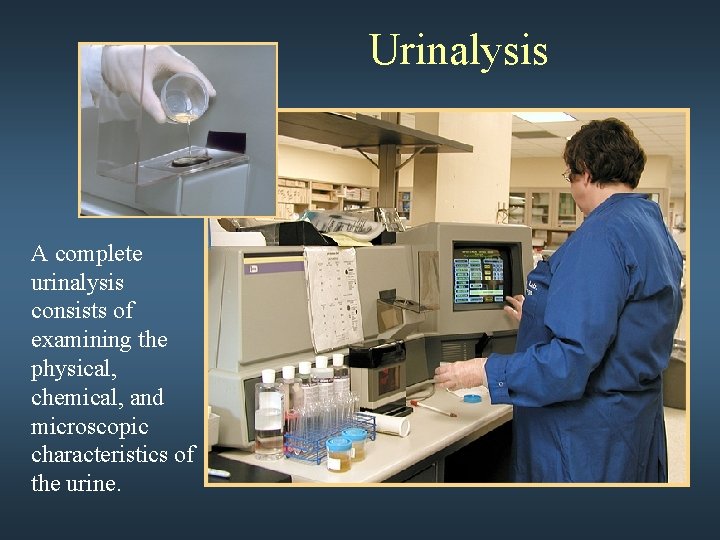 Urinalysis A complete urinalysis consists of examining the physical, chemical, and microscopic characteristics of
