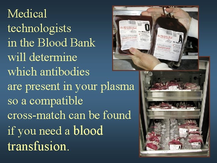 Medical technologists in the Blood Bank will determine which antibodies are present in your