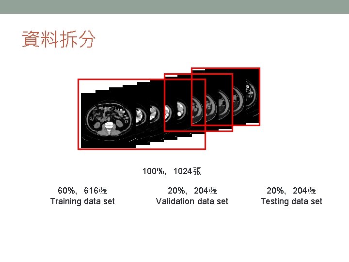 資料拆分 100%,1024張 60%,616張 Training data set 20%,204張 Validation data set 20%,204張 Testing data set 資料拆分 100%,1024張 60%,616張 Training data set 20%,204張 Validation data set 20%,204張 Testing data set