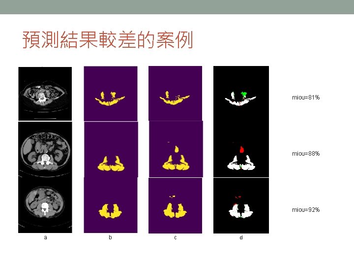 預測結果較差的案例 miou=81% miou=88% miou=92% a b c d 預測結果較差的案例 miou=81% miou=88% miou=92% a b c d