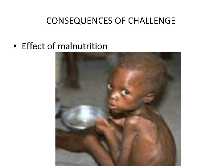 CONSEQUENCES OF CHALLENGE • Effect of malnutrition 