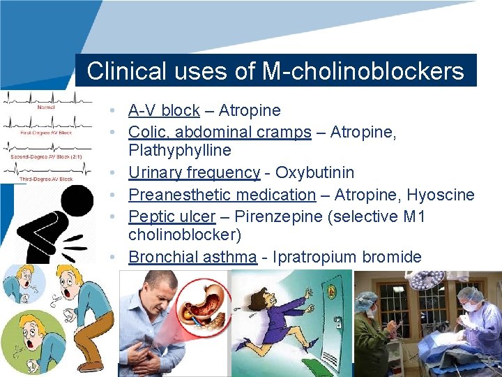 Clinical uses of M-cholinoblockers • A-V block – Atropine • Colic, abdominal cramps –