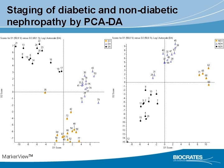 Staging of diabetic and non-diabetic nephropathy by PCA-DA Marker. View. TM 
