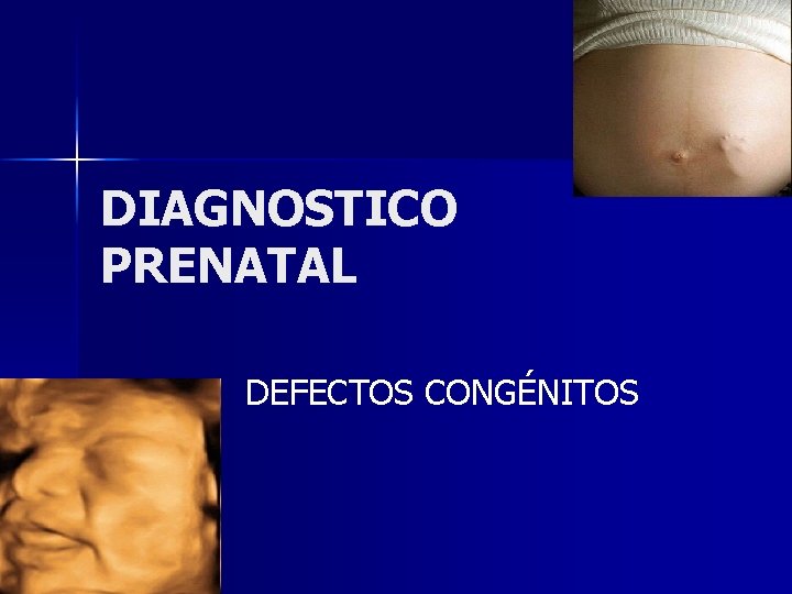 DIAGNOSTICO PRENATAL DEFECTOS CONGÉNITOS 