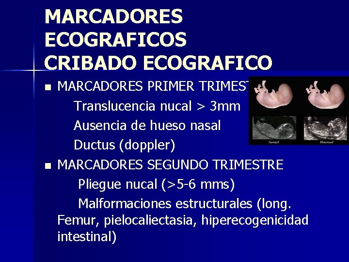 MARCADORES ECOGRAFICOS CRIBADO ECOGRAFICO n n MARCADORES PRIMER TRIMESTRE Translucencia nucal > 3 mm