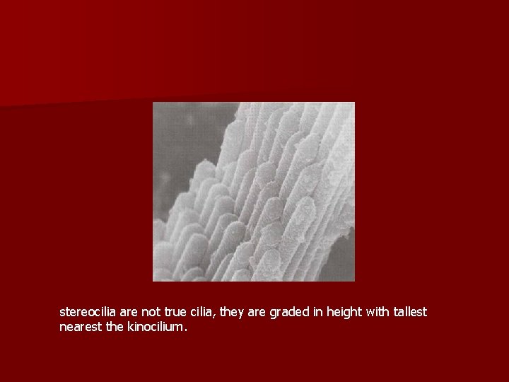 stereocilia are not true cilia, they are graded in height with tallest nearest the