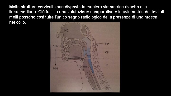 Molte strutture cervicali sono disposte in maniera simmetrica rispetto alla linea mediana. Ciò facilita