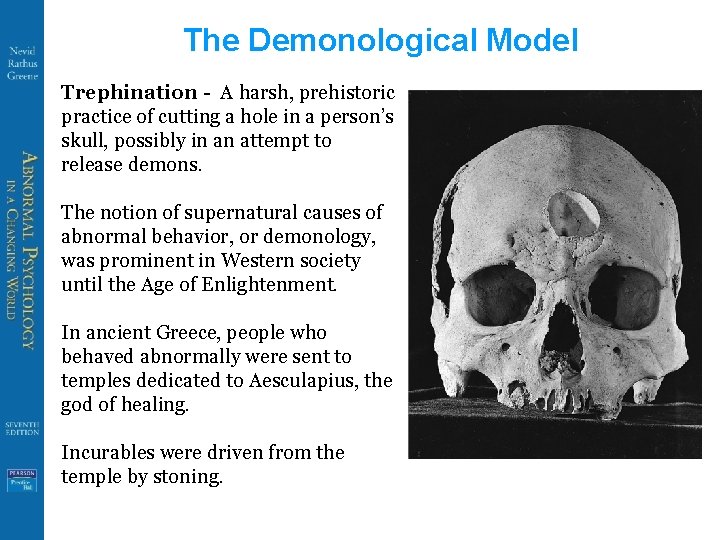 The Demonological Model Trephination - A harsh, prehistoric practice of cutting a hole in