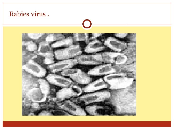Rabies virus. 