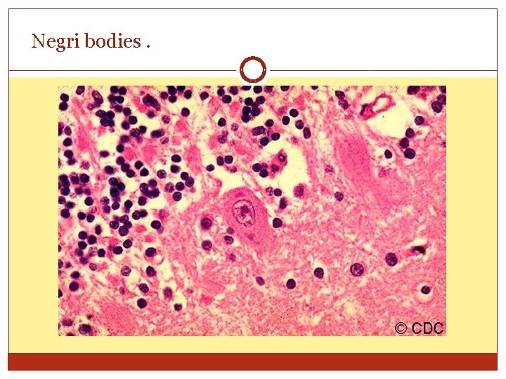Negri bodies. 