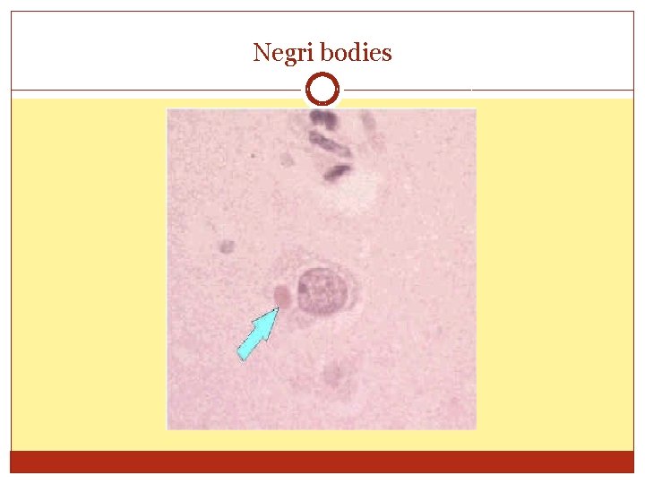 Negri bodies 