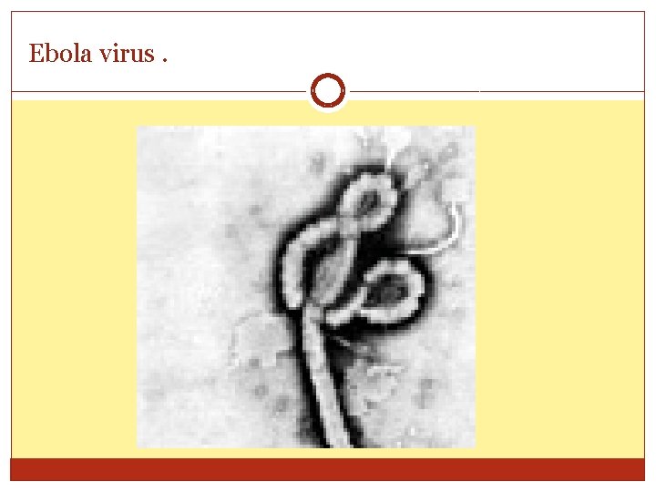 Ebola virus. 