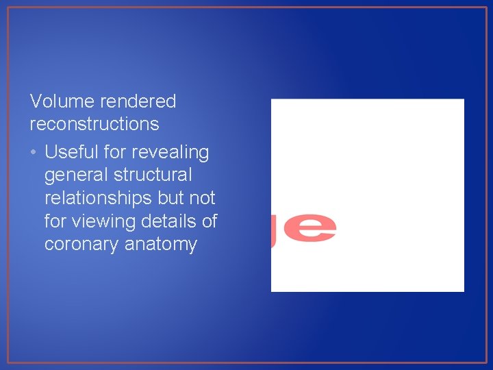Volume rendered reconstructions • Useful for revealing general structural relationships but not for viewing