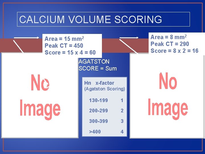 CALCIUM VOLUME SCORING Area = 8 mm 2 Peak CT = 290 Score =