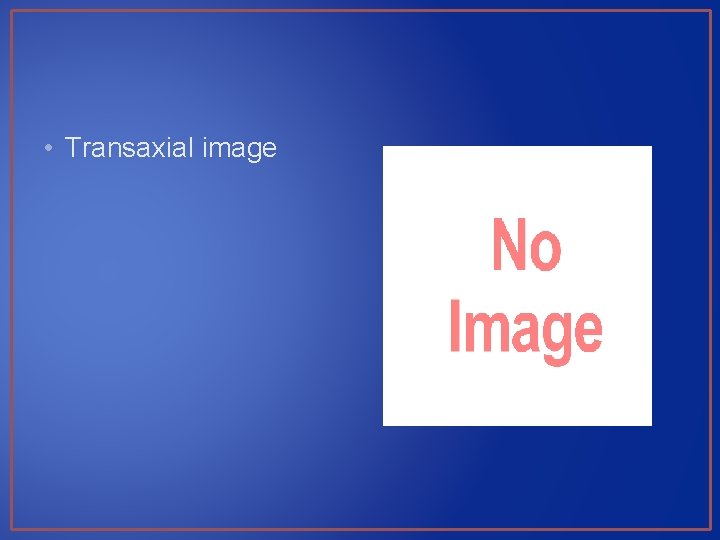  • Transaxial image 