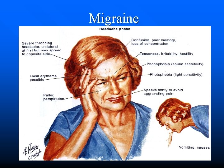 Migraine 