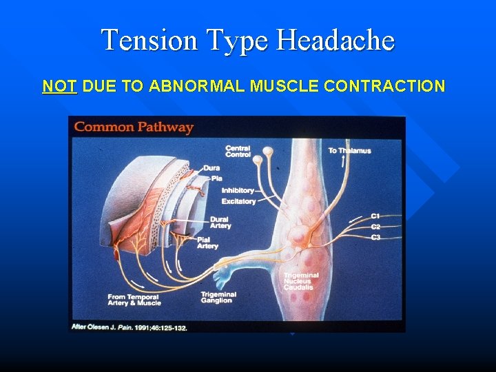 Tension Type Headache NOT DUE TO ABNORMAL MUSCLE CONTRACTION 