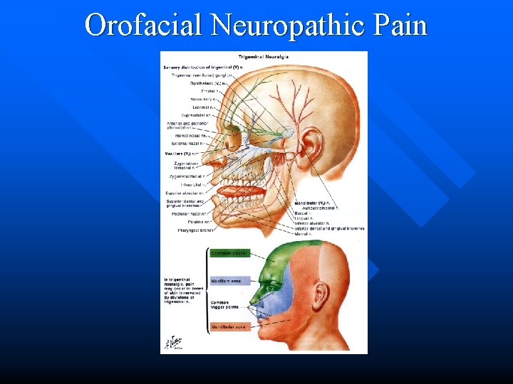 Orofacial Neuropathic Pain 