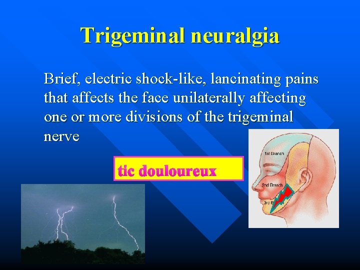 Trigeminal neuralgia Brief, electric shock-like, lancinating pains that affects the face unilaterally affecting one