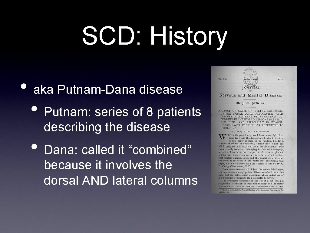 SCD: History • aka Putnam-Dana disease • Putnam: series of 8 patients describing the