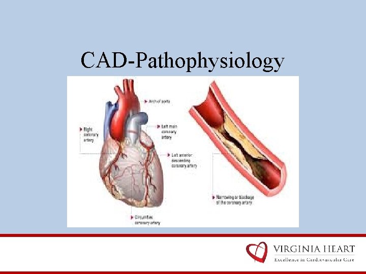 CAD-Pathophysiology 