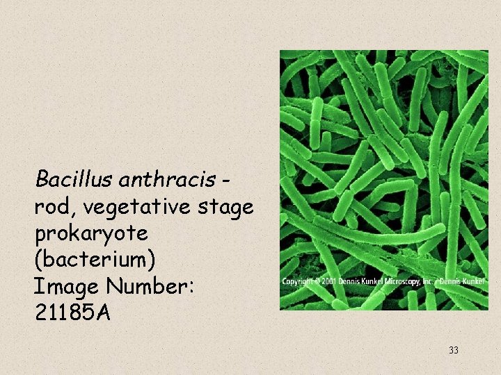  Bacillus anthracis rod, vegetative stage prokaryote (bacterium) Image Number: 21185 A 33 