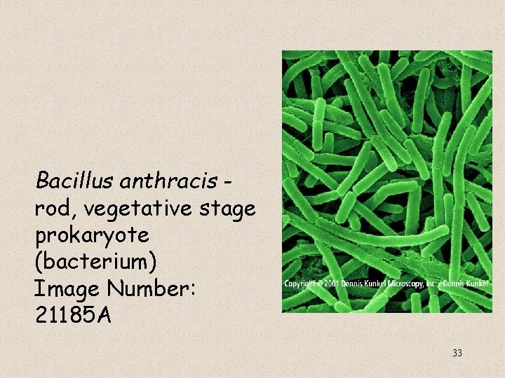Bacillus anthracis rod, vegetative stage prokaryote (bacterium) Image Number: 21185 A 33 Bacillus anthracis rod, vegetative stage prokaryote (bacterium) Image Number: 21185 A 33