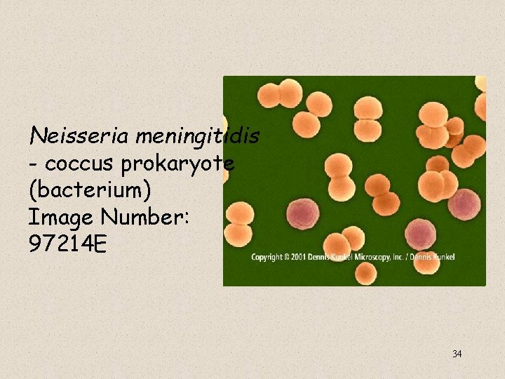  Neisseria meningitidis - coccus prokaryote (bacterium) Image Number: 97214 E 34 