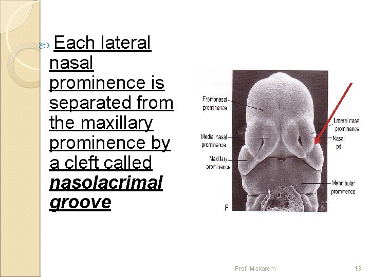 Each lateral nasal prominence is separated from the maxillary prominence by a cleft called