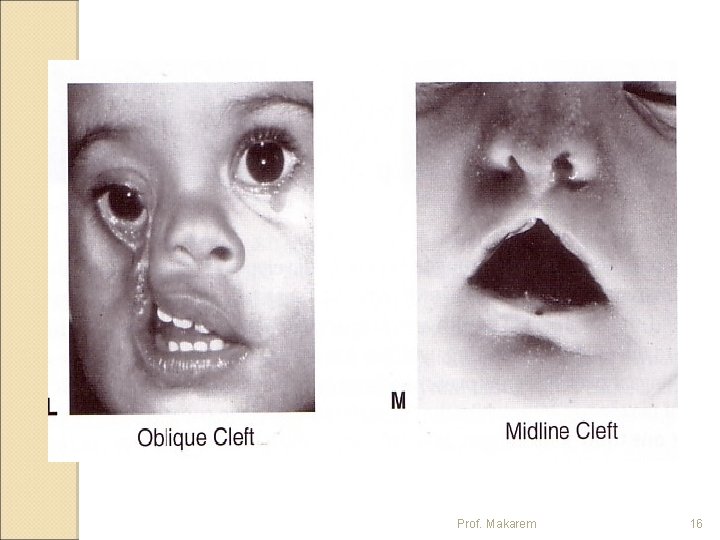 Prof. Makarem 16 