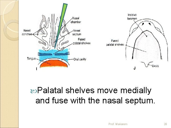  Palatal shelves move medially and fuse with the nasal septum. Prof. Makarem 28