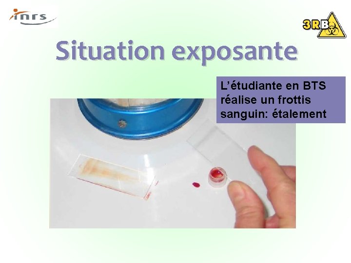 Situation exposante L’étudiante en BTS réalise un frottis sanguin: étalement 